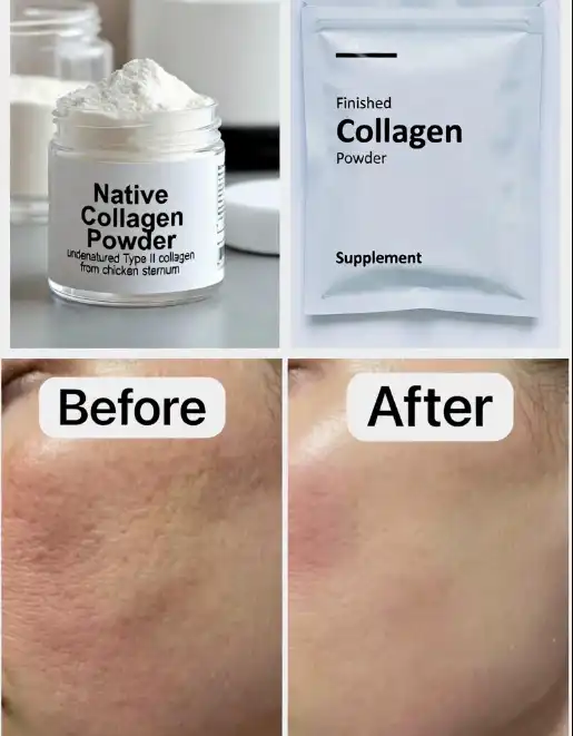 Top Benefits of Native Collagen Powder for Skin Elasticity and Joint Health